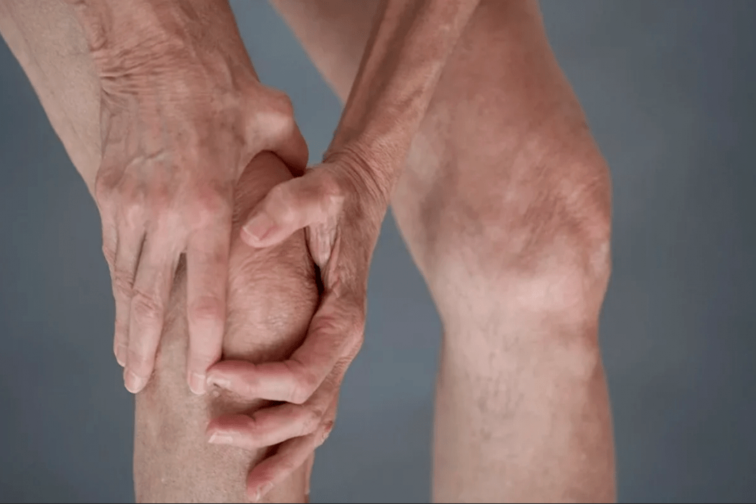 liigesevalu võib olla artroosi või artriidi põhjus