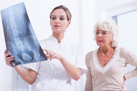 Röntgenuuring on informatiivne viis selgroo osteokondroosi diagnoosimiseks