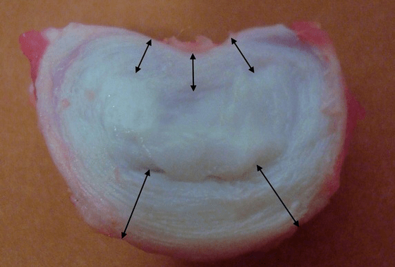 milline näeb välja lülidevaheline ketas