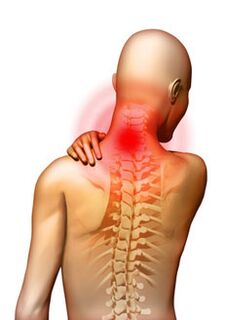 Valu on emakakaela osteokondroosi peamine sümptom