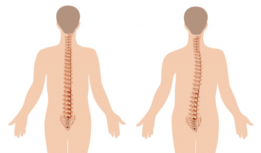 osteokondroosi ilming