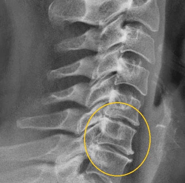 Diagnostiline pilt